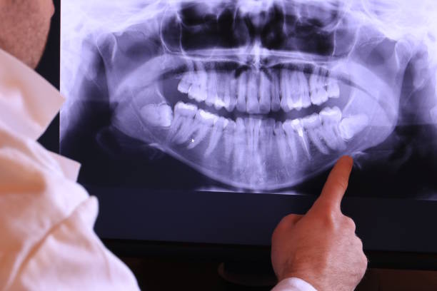 Best Emergency Wisdom Teeth Removal in Brinkley, AR
