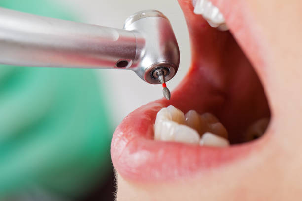 Best Walk-In Emergency Dentist in Brinkley, AR